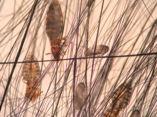 cat lice